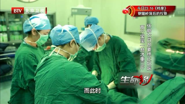 双胎产妇怀胎7月剖宫产大儿子仅1斤